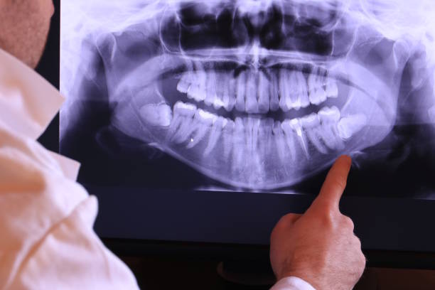Best Emergency Treatment for Dental Infections or Abscesses in Marseles, IL