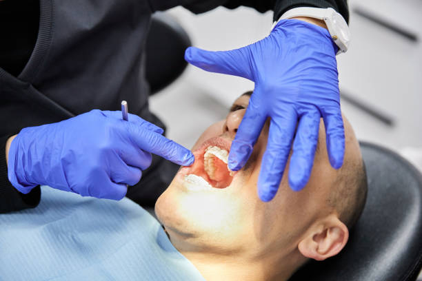 Best Emergency Dental Care for Broken or Chipped Teeth in Marseles, IL
